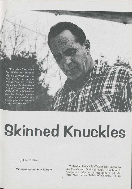 Skinned Knuckles