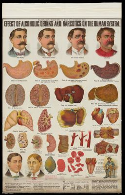 Hardacre's temperance map illustrating the effect of alcoholic drinks and narcotics on the human system.